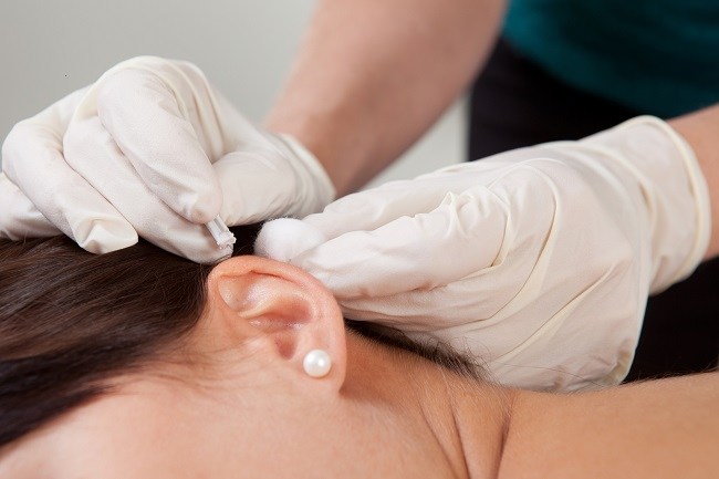 Deretan Manfaat Terapi Akupunktur untuk Kesehatan Alodokter