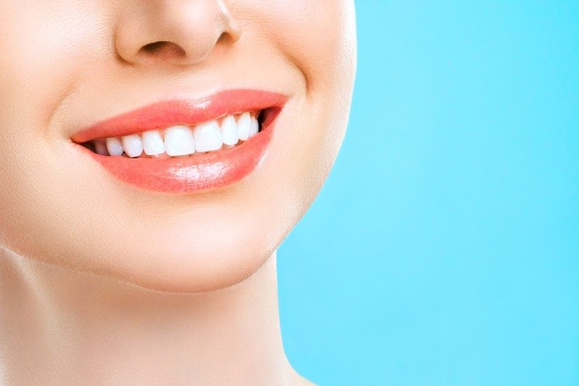 9 Cara Merapikan Gigi Agar Makin Percaya Diri - Alodokter